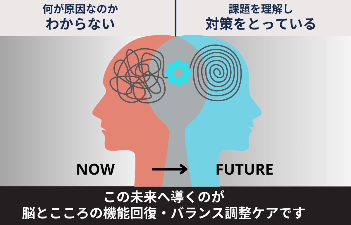 1 brainshift